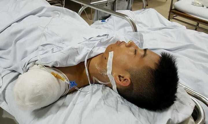 Cư dân mạng xôn xao chuyện chàng trai cứu bạn bị ô tô cán cụt tay