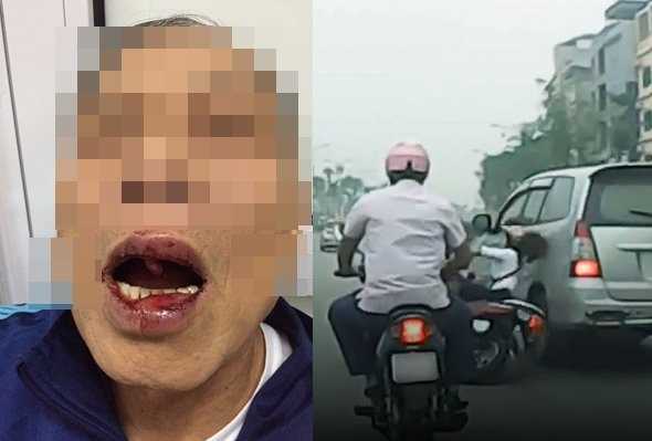 Sau vụ cán bộ Sở ngoại vụ đánh người, Hà Nội sắp ra quy tắc ứng xử