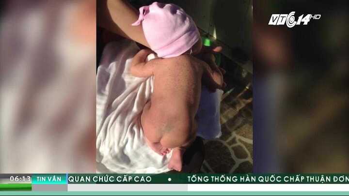 Thực hư tin đồn lòng trắng trứng, cốt chanh trị chứng vặn mình ở bé sơ sinh