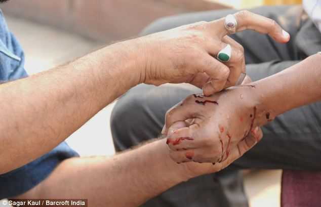 Dân Ấn Độ xếp hàng dài để được rạch chân, tay chữa bệnh