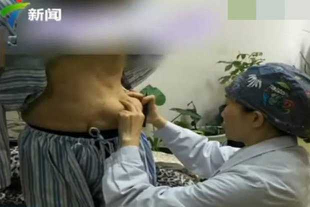 Hậu phẫu thuật nâng cấp vòng 1, tá hỏa phát hiện ngực... rơi xuống bụng