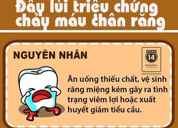 Bạn hay bị chảy máu chân răng, hãy làm theo cách sau