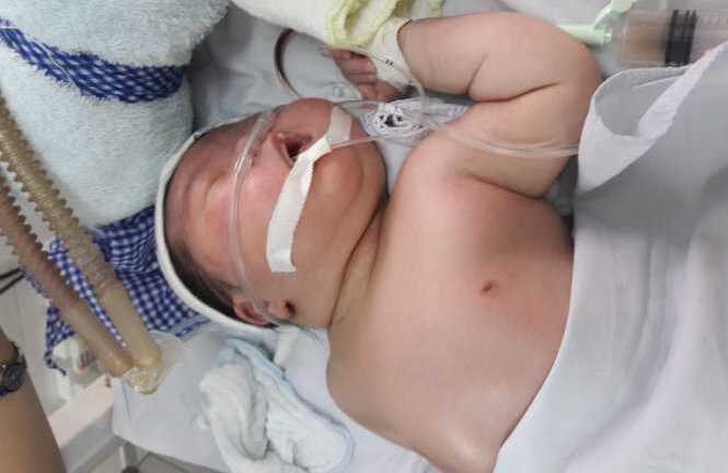 Tạm đình chỉ bác sĩ bắt sản phụ sinh thường con 4,8 kg khiến bé gãy xương đòn, xẹp phổi