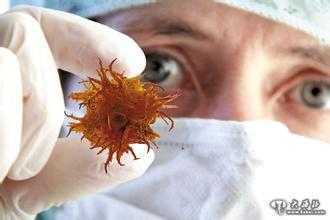 Uống 5 ly rượu mỗi ngày có thể mắc 10 loại ung thư