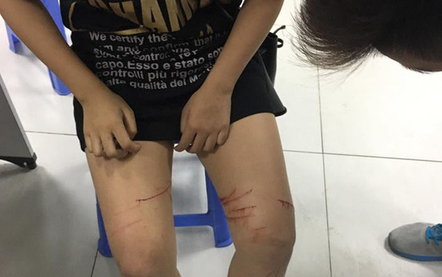 Truy bắt kẻ biến thái rạch đùi thiếu nữ trên phố Hà Nội