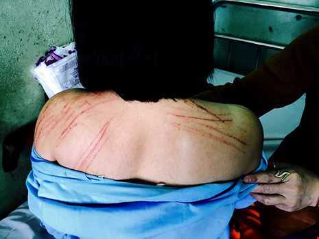 Nữ luật sư tố bị đánh gãy 2 cái răng khi tham dự tòa