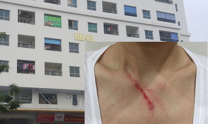 Khuyên không nhổ nước bọt nơi công cộng, một phụ nữ bị hành hung trong thang máy