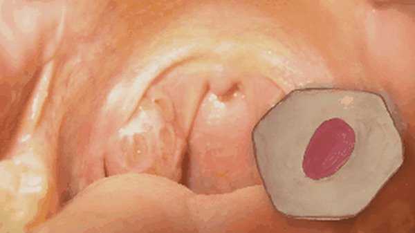 Miệng 'bốc mùi' là do căn bệnh nguy hiểm này