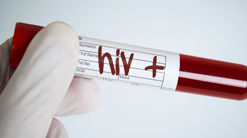 Sắp có văcxin đẩy lùi căn bệnh thế kỷ HIV