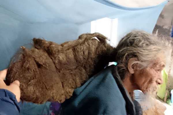 Dị nhân có mái tóc 'ma làm' hãi hùng sau trận ốm liệt giường ở Quảng Ninh