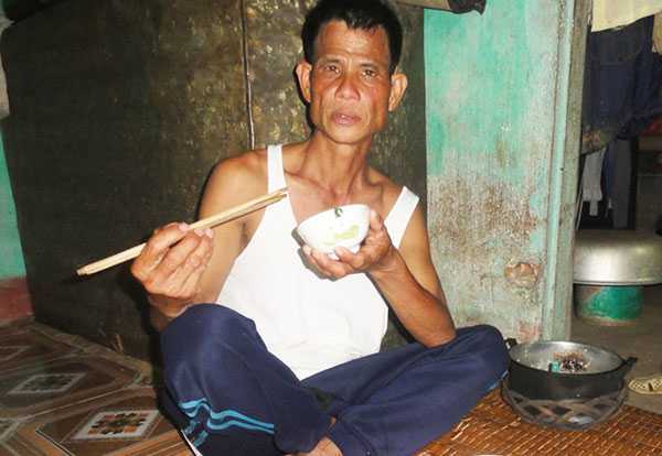 Lạ lùng người đàn ông có dạ dày không đáy, cả đời 4 lần được ăn no