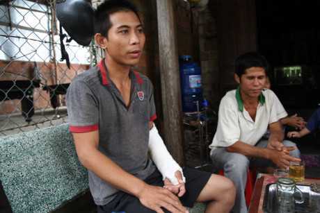 Sa thải trưởng công an xã đánh dân chấn thương sọ não