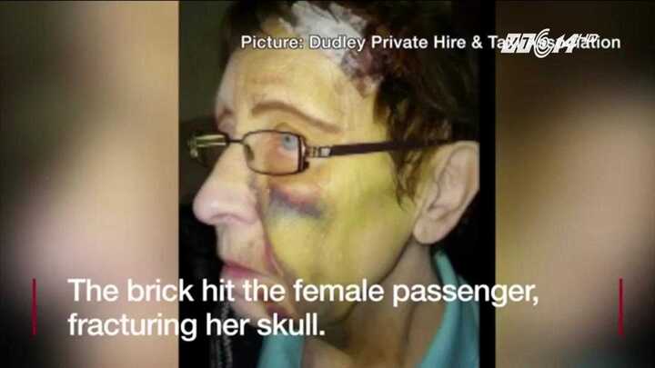 Bị 'trẻ trâu' ném đá, khách đi taxi rách mặt, chấn thương sọ não