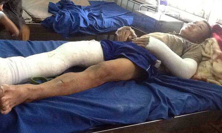 Cuối năm không trả tiền công, còn đánh gãy chân tay nhân viên