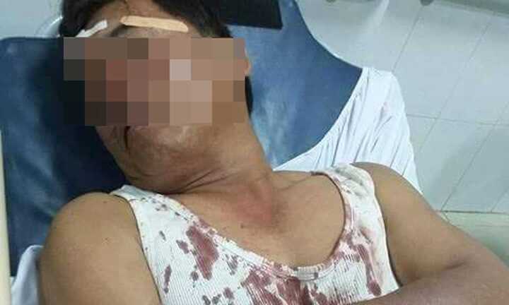 Can ngăn trai làng hỗn chiến, một công an viên bị đánh vỡ đầu
