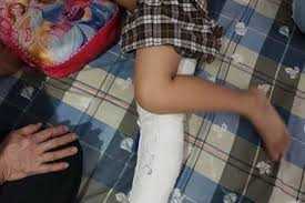 Học sinh gãy chân khi chơi trong sân trường: Đã xác định tài xế gây tai nạn