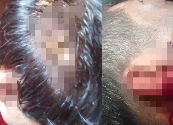 Khởi tố vụ hỗn chiến đêm giao thừa ở Đắk Lắk