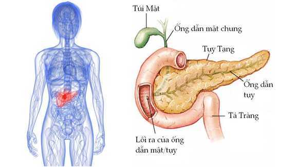 Nhận diện nguy cơ ung thư tụy