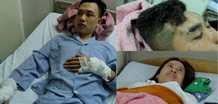 Nổ xe khách trong đêm, 14 người thương vong: Phút kinh hoàng qua lời kể nạn nhân