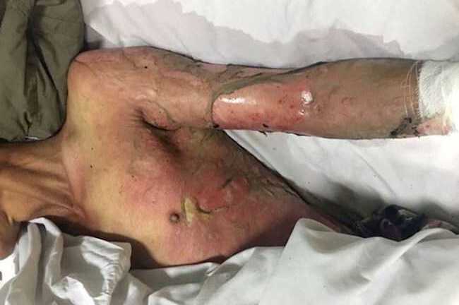 Không cho khách nợ 30 nghìn đồng, chủ quán bida bị thiêu sống