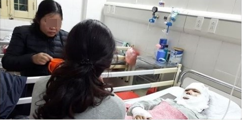 55 quả bóng bay phát nổ, thiếu nữ bị bỏng hết khuôn mặt