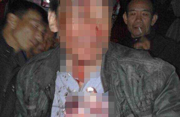 Đi đám cưới về, người đàn ông bị chém nhập viện