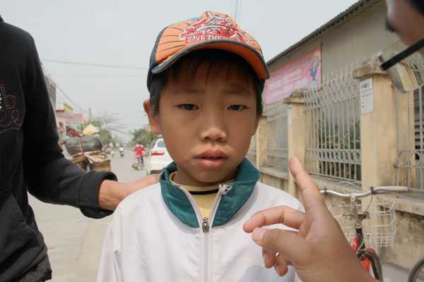 Bị bạn bắn que xiên thịt trúng mắt, một học sinh lớp 3 bị mù: Phòng giáo dục vào cuộc