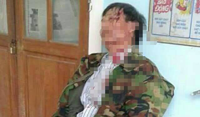 Dân tố bị trưởng công an xã đánh vỡ đầu vì ghi âm buổi làm việc