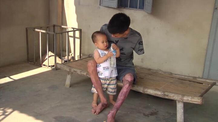 Rơi nước mắt hoàn cảnh chàng trai cụt tay bị vợ bỏ, phải 'gà trống nuôi con'