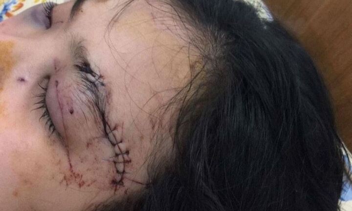 Cô gái cầm đầu 20 giang hồ 'truy sát', cắt tai thiếu nữ ở Sài Gòn