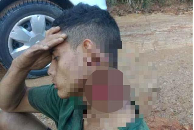 Bị chém gần lìa cổ, chàng trai giữ đầu khỏi lệch trong rừng cả đêm chờ cứu hộ