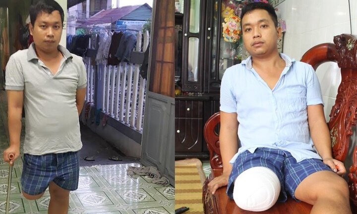 Nạn nhân bị cưa chân đề nghị khởi tố bác sĩ