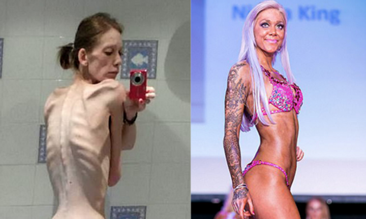 Từ 'xác khô' trở thành nhà vô địch thể hình sau 18 tháng