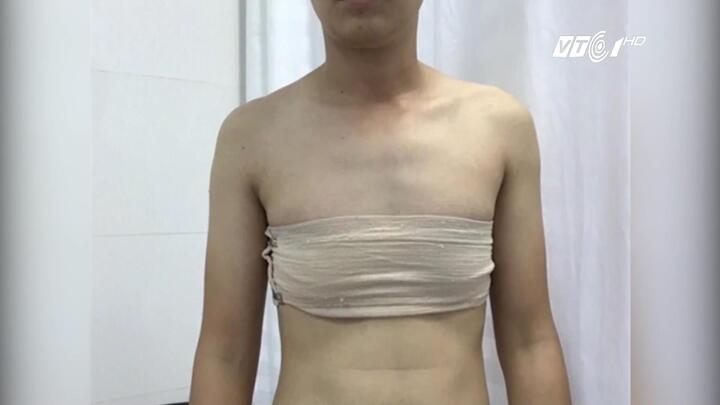 Kỳ lạ người có bộ phận sinh dục nửa nam nửa nữ