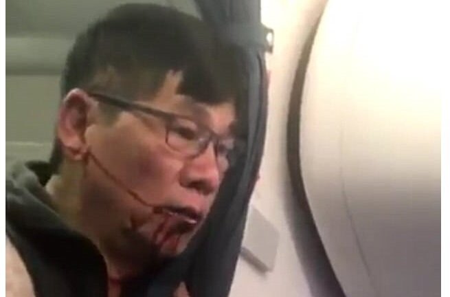 Hành khách gốc Việt bị United Airlines đánh đập dã man có cơ thắng kiện 'nhiều triệu USD'