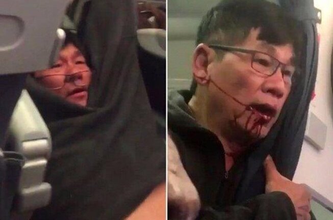 Lộ video bác sỹ gốc Việt tranh cãi với nhân viên an ninh trước khi bị kéo xuống máy bay