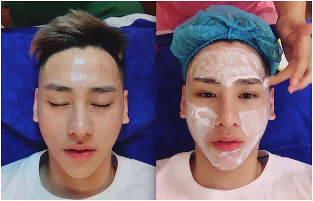 ‘Vẻ đẹp tự nhiên không dao kéo’ dành cho Nam