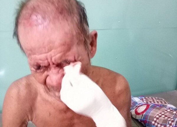 Nghịch tử đánh cha nhập viện ở Bình Dương: Sáng đánh u đầu, chiều vác dao đòi chém