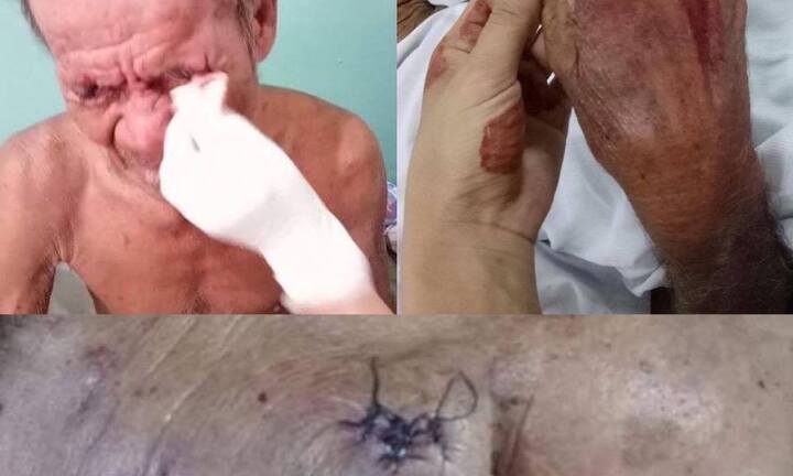 Nghịch tử đánh cha nhập viện ở Bình Dương: Người quay clip tiết lộ thông tin bất ngờ