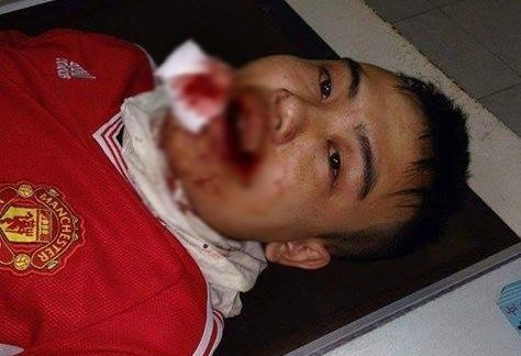 Truy tìm tài xế taxi 29A – 053.78 hành hung cặp vợ chồng giữa Thủ đô