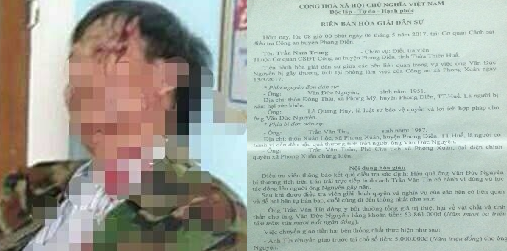 Đánh vỡ đầu dân, trưởng công an xã phải đền bù hơn 53 triệu đồng