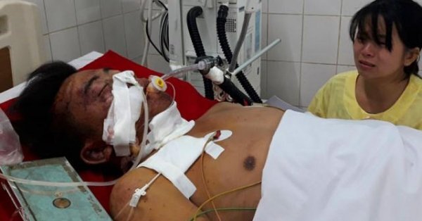 Tai nạn thảm khốc ở Gia Lai: Xét nghiệm ma túy lần 2 với tài xế xe tải