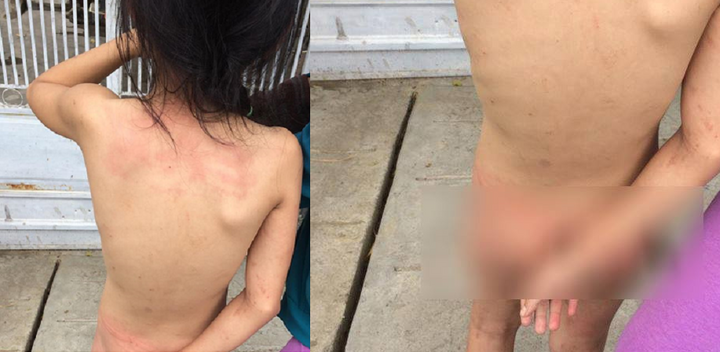Bé gái bị đánh, trần truồng đứng giữa đường: Thông tin mới nhất