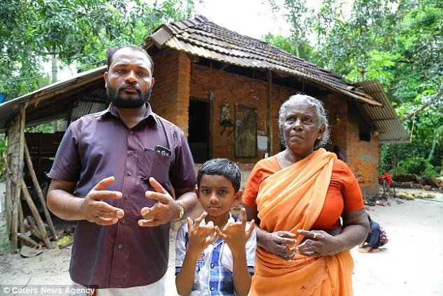 'Lời nguyền' suốt 90 năm khiến 140 người trong một dòng họ mang bàn tay nhện