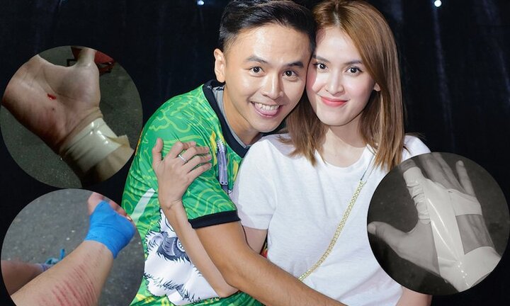 Tú Vi xót xa khi Văn Anh bị ngã rách tay, thương tích khắp người