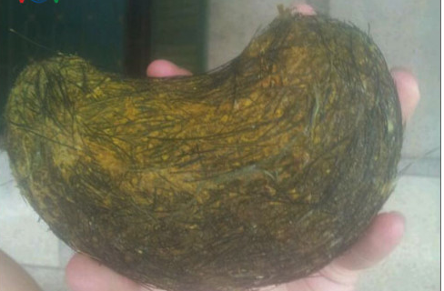 Mổ lợn nái nuôi 13 năm, phát hiện 'cát lợn' quý hiếm