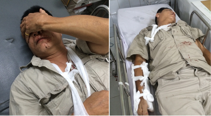 Nhóm côn đồ truy sát dã man người đàn ông 61 tuổi ở Hà Nội