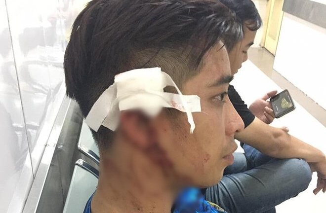 Đến phòng tập gym cùng bạn gái, bị nhân viên dùng bình cứu hỏa đánh vỡ đầu