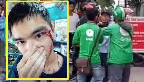 Nam thanh niên bị người đội mũ GrabBike vô cớ chửi bới, hành hung
