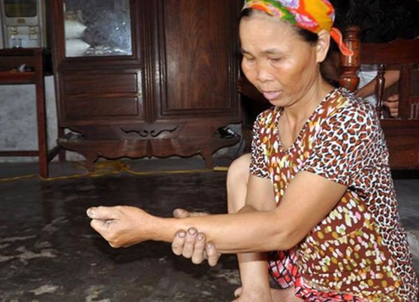 Gặp người phụ nữ từng 